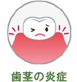 歯茎の炎症